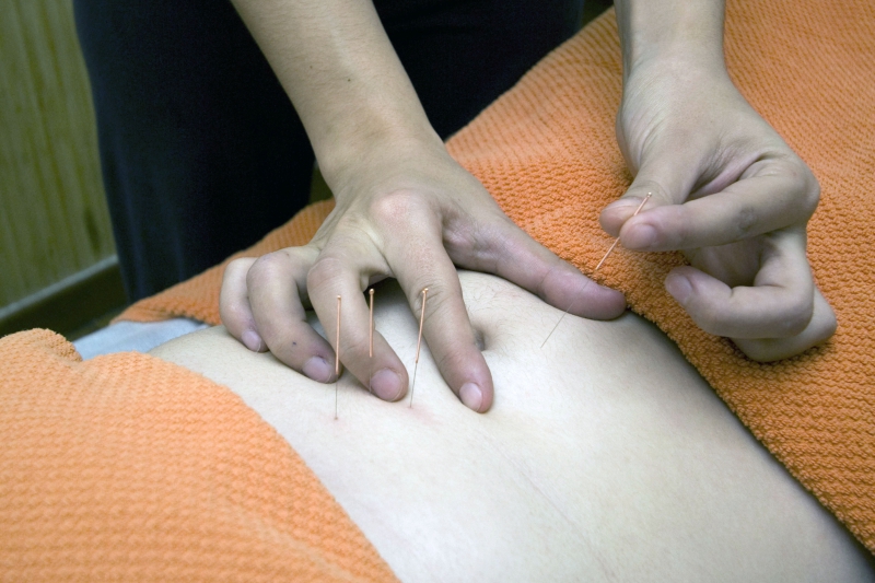 osteopathe-VALBONNE-min_acupuncture-4175625